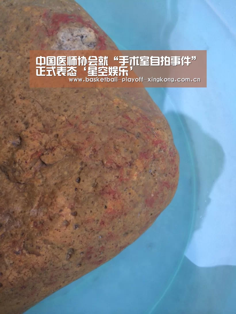 中国医师协会就“手术室自拍事件”正式表态‘星空娱乐’(图1) 星空体育网站